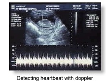 Detecting heartbeat with doppler